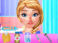 Trò chơi Điều trị dị ứng mùa xuân của Anna trực tuyến